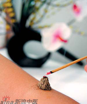 節(jié)氣灸” 冬至，你灸了嗎？