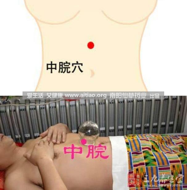 中脘穴位于腹部正中線，臍上4寸的位置上。每天艾灸10-15分鐘，能有效緩解胃部不適的癥狀，同時(shí)有助于祛濕。